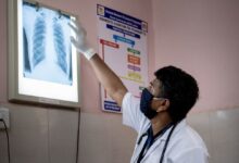 Photo of Funding cuts jeopardise global fight against tuberculosis, WHO warns