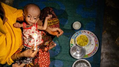 Photo of Bangladesh: Rohingya children’s acute hunger surges amid funding cuts