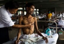 Photo of TB cases fall for first time since pandemic