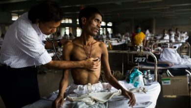 Photo of TB cases fall for first time since pandemic