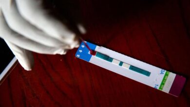 Photo of В ООН приветствовали принятие в США нового пакета финансирования борьбы с ВИЧ/СПИДом