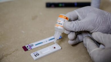 Photo of ‘Perilous moment’ threatens to reverse years of gains in HIV/AIDS response