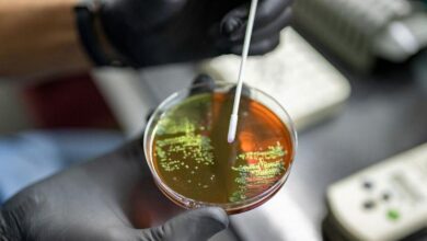 Photo of ВОЗ оценила риски, связанные с чумой, для России и Европы